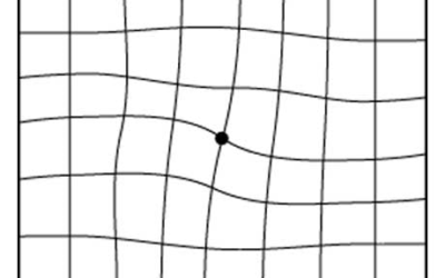 The Amsler Grid